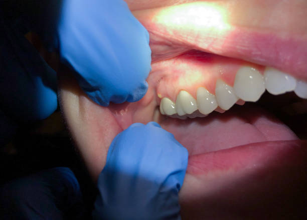 Best After-Hours Dental Trauma Care in K I Sawyer, MI
