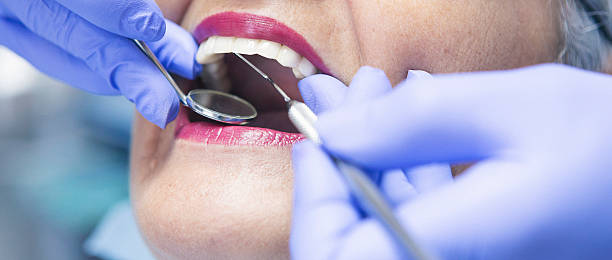 Best Urgent Care for Lost Fillings or Crowns in K I Sawyer, MI